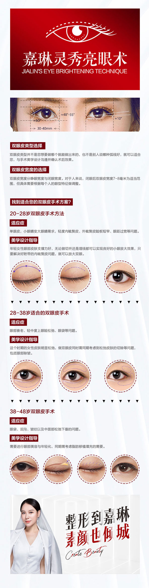重睑术分解.jpg