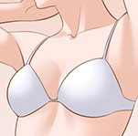  胸部整形